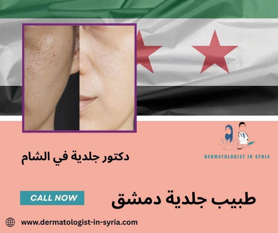 اشهر طبيب جلدية دمشق اشهر طبيب جلدية دمشق