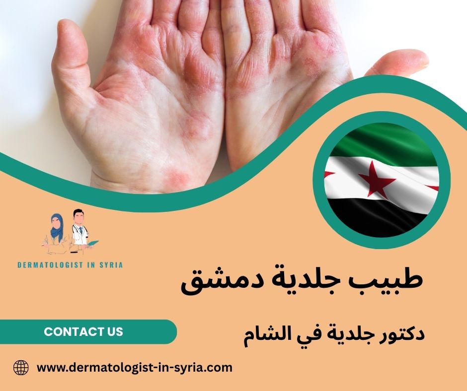 ما هي أكثر الأمراض الجلدية شيوعاً؟ ما هي أكثر الأمراض الجلدية شيوعاً؟
