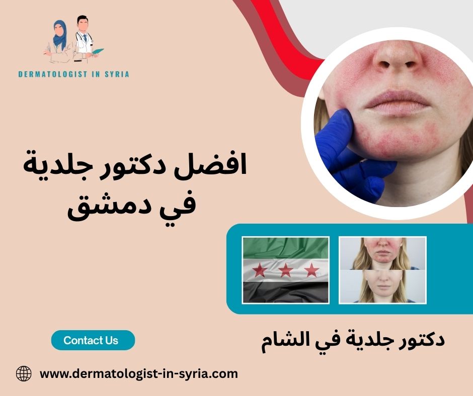 افضل دكتور جلدية في دمشق