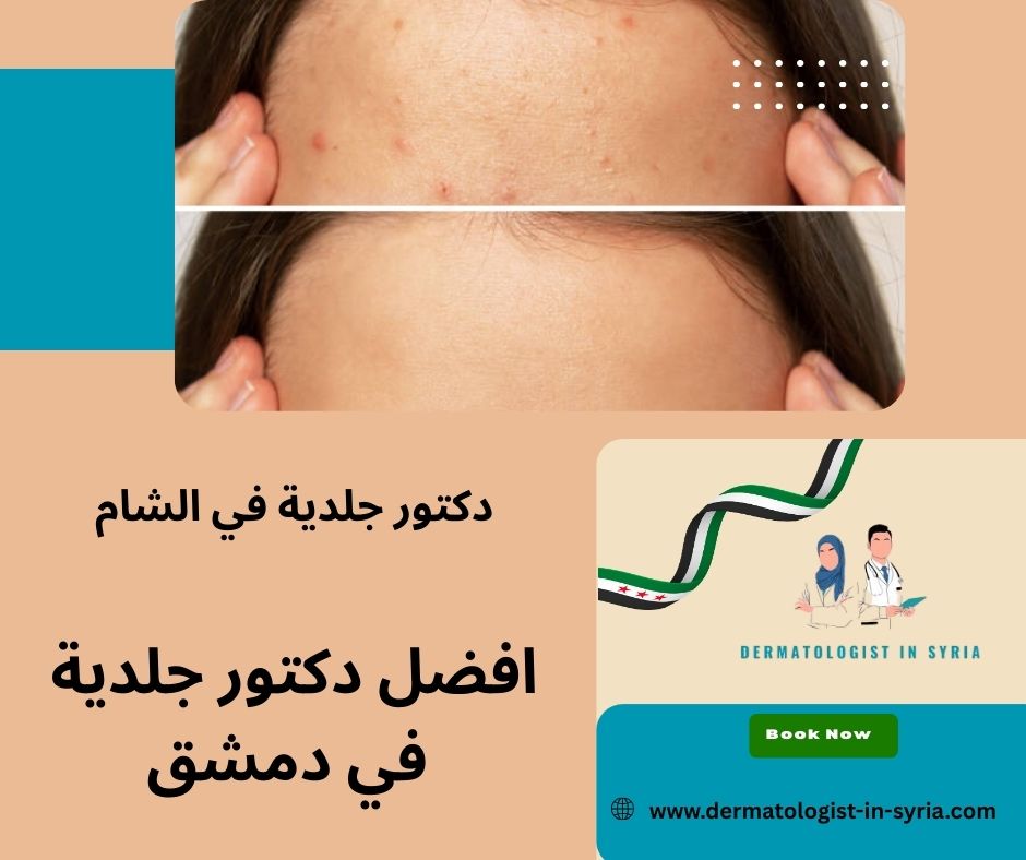 دكتور جلدية دمشق باب مصلى دكتور جلدية دمشق باب مصلى