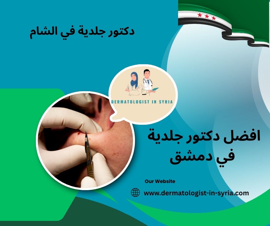 دكتور جلدية دمشق المزة دكتور جلدية دمشق المزة