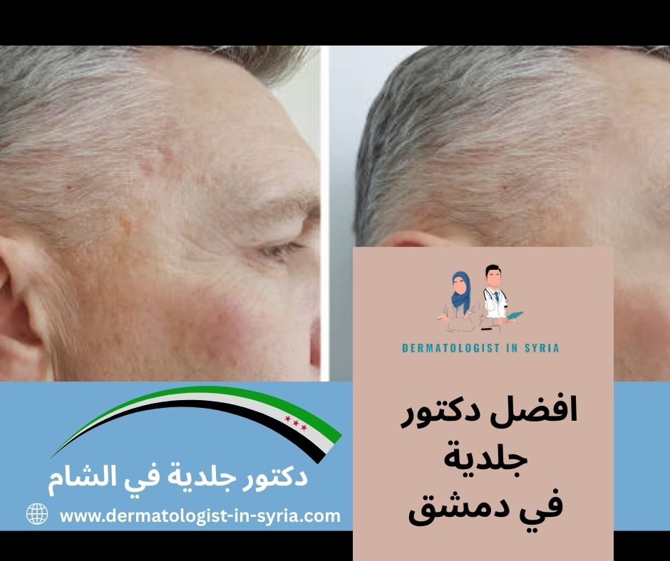 أطباء جلدية في دمشق الجسر الأبيض أطباء جلدية في دمشق الجسر الأبيض