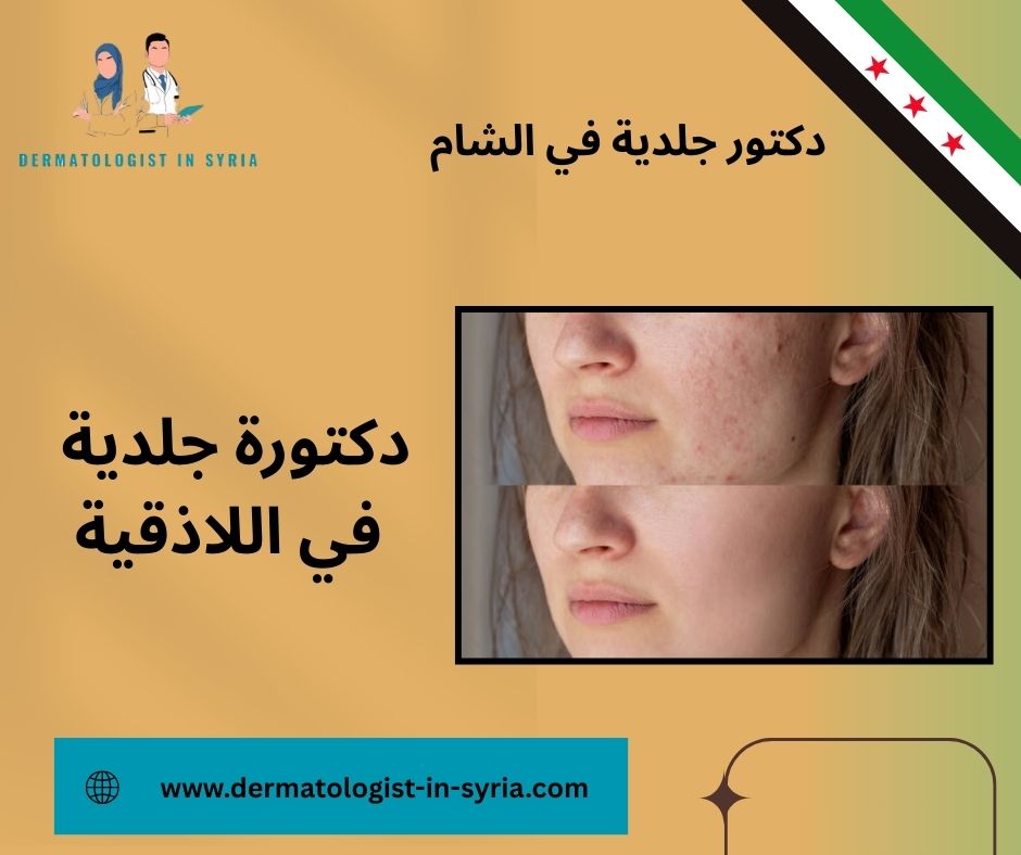 اشطر دكتورة جلدية في اللاذقية اشطر دكتورة جلدية في اللاذقية