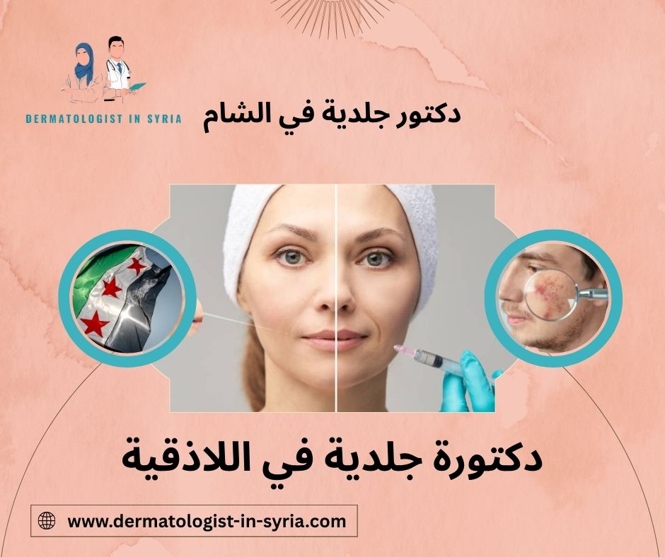 دكتورة جلدية في اللاذقية