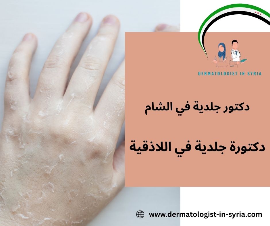 هل تقدم دكتورة جلدية في اللاذقية علاجات تجميلية؟ هل تقدم دكتورة جلدية في اللاذقية علاجات تجميلية؟