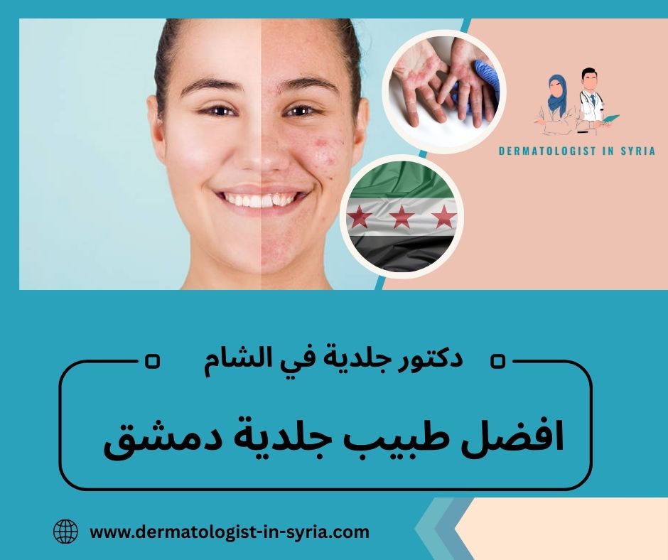 افضل طبيب جلدية دمشق