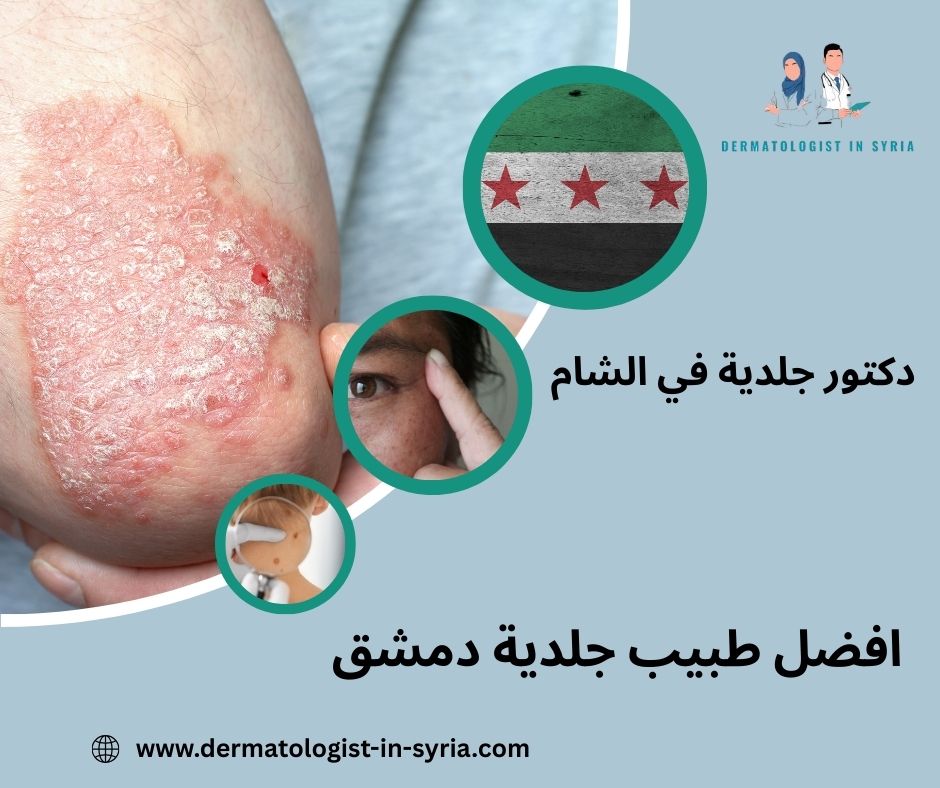 افضل طبيب جلدية دمشق افضل طبيب جلدية دمشق