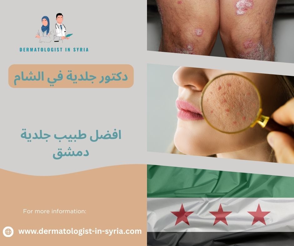 مراكز تجميل في دمشق مراكز تجميل في دمشق