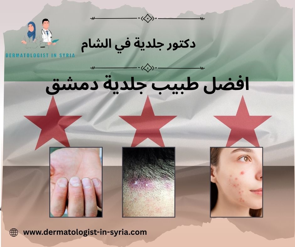 دكتور جلدية بشام دكتور جلدية بشام