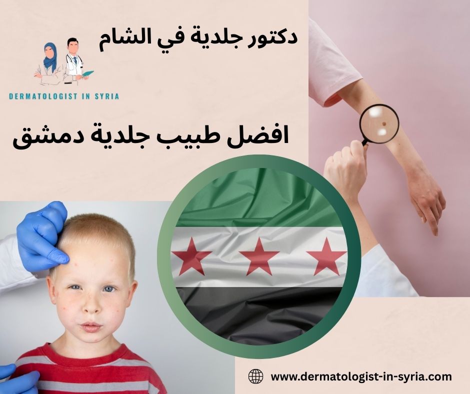 افضل طبيب جلدية بدمشق افضل طبيب جلدية بدمشق