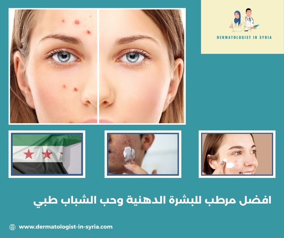 افضل مرطب للبشرة الدهنية وحب الشباب طبي