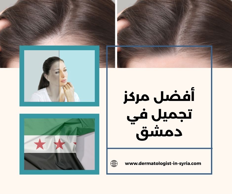 أفضل مركز تجميل في دمشق