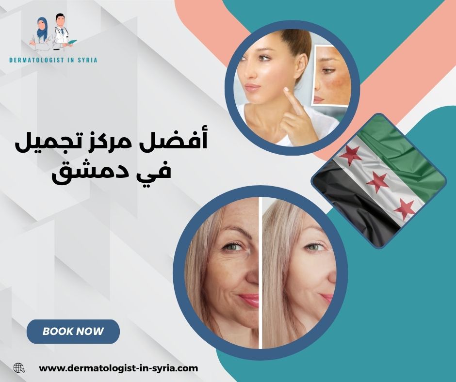 أفضل مركز تجميل في دمشق