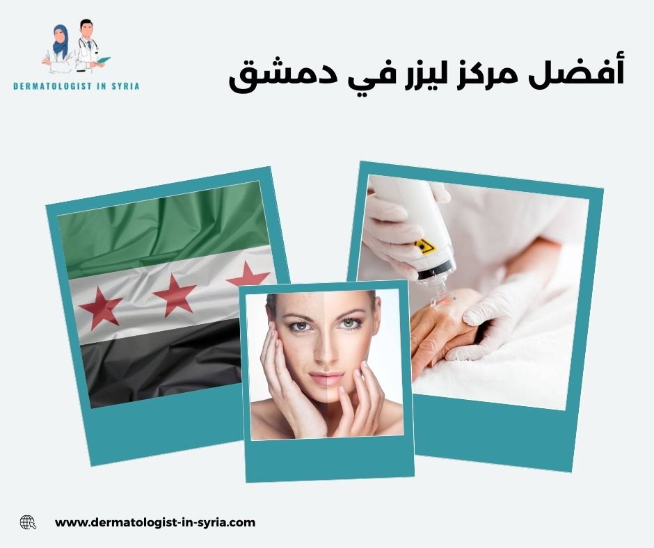 أفضل مركز ليزر في دمشق
