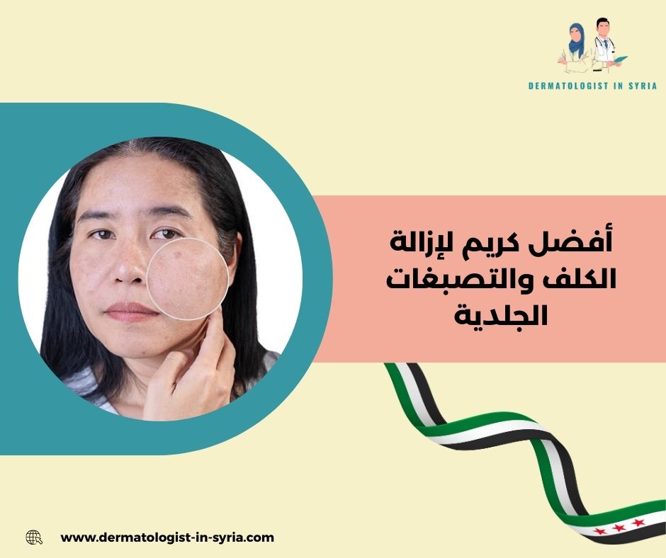 الكلف الهرموني