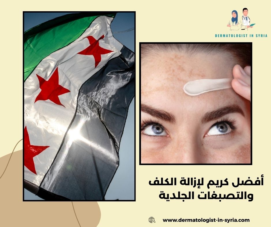 التصبغات الشمسية