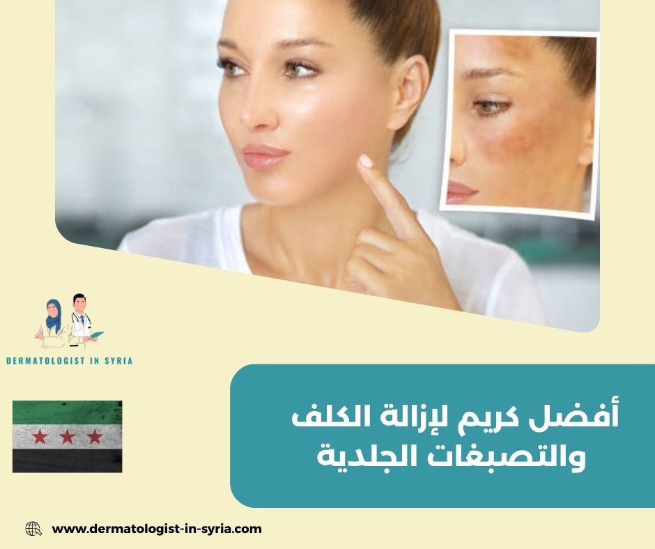 ما هو أفضل كريم لإزالة الكلف والتصبغات الجلدية؟