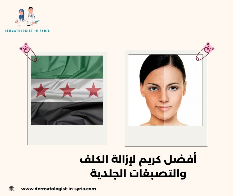 أفضل كريم لإزالة الكلف والتصبغات الجلدية