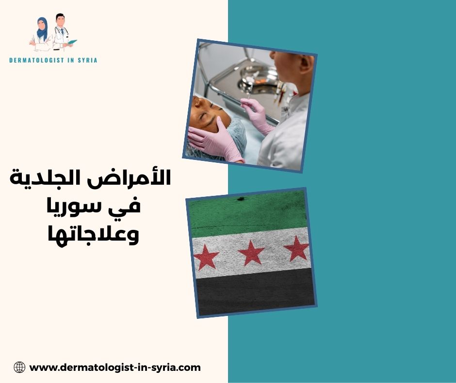 الأمراض الجلدية في سوريا وعلاجاتها