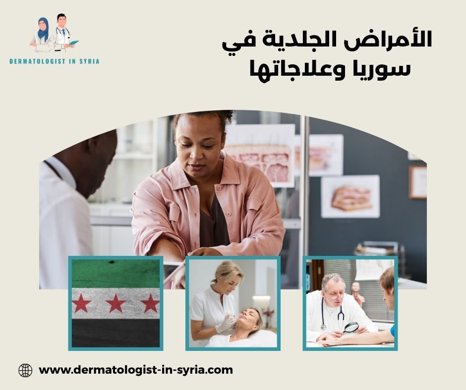  الأمراض الجلدية في سوريا وعلاجاتها