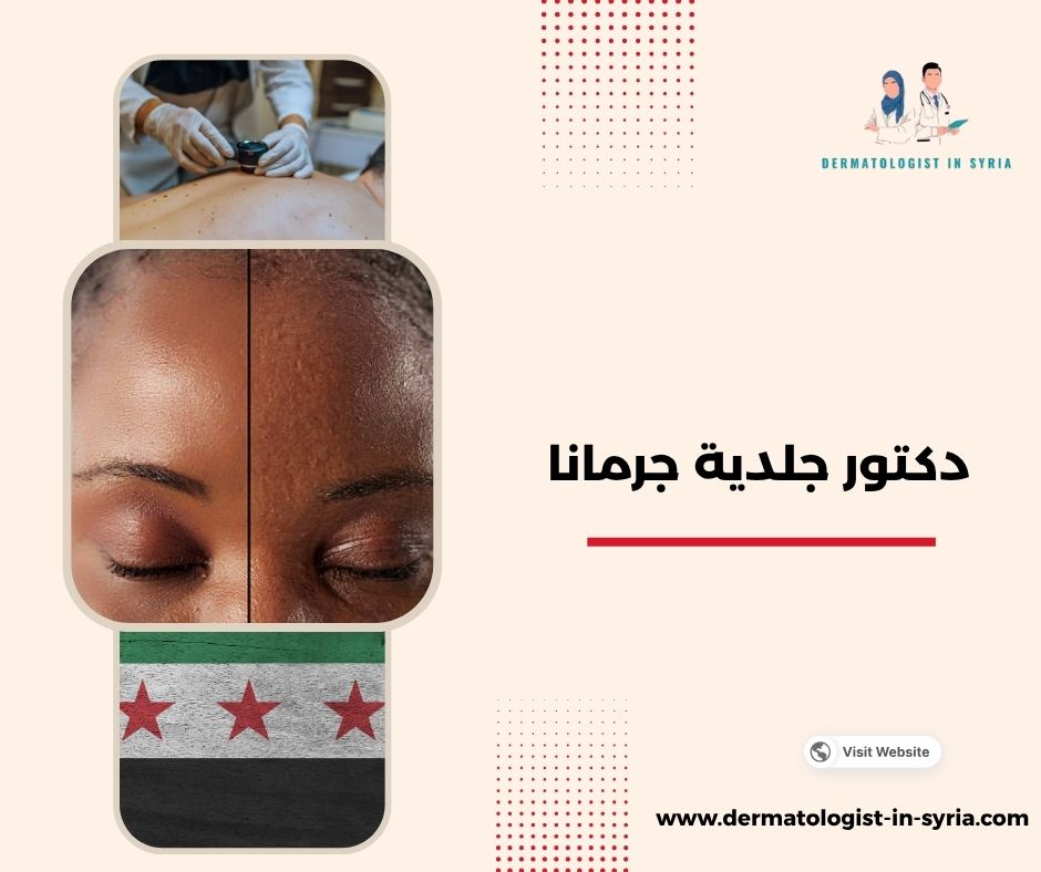 دكتور جلدية جرمانا