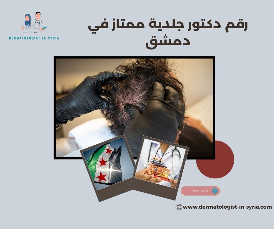رقم دكتور جلدية ممتاز في دمشق