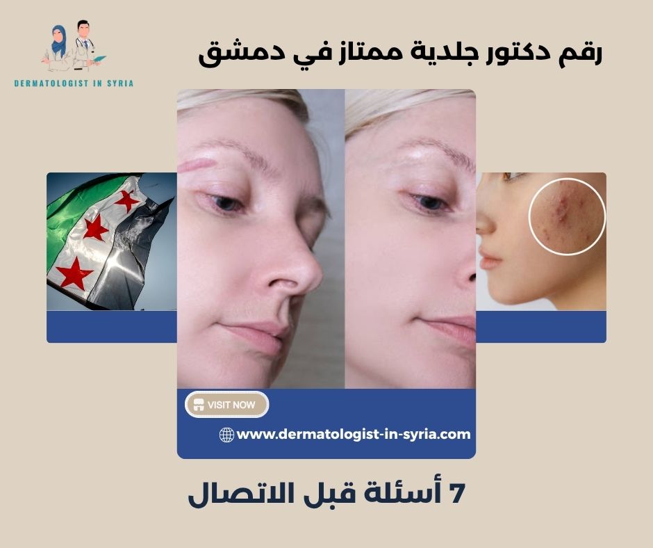 رقم دكتور جلدية ممتاز في دمشق