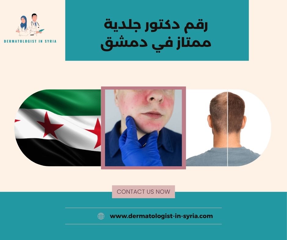 رقم دكتور جلدية ممتاز في دمشق