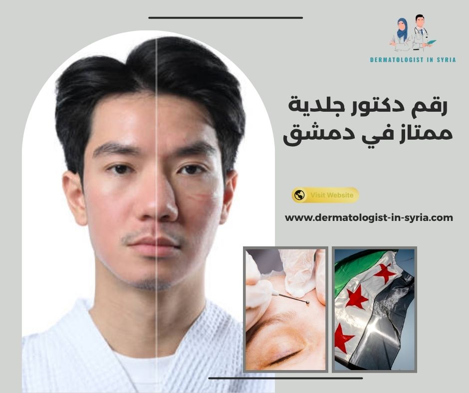 رقم دكتور جلدية ممتاز في دمشق