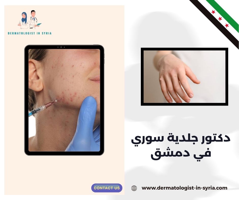 دكتور جلدية سوري في دمشق