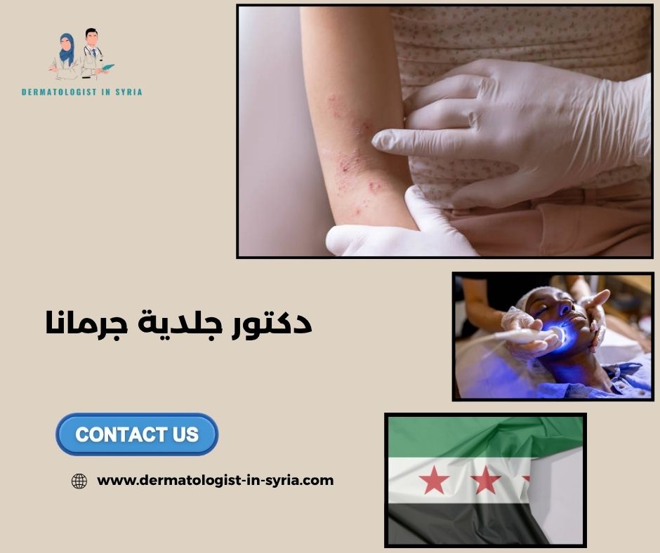 دكتور جلدية جرمانا