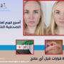 أسرع كريم لعلاج الصدفية الشعر