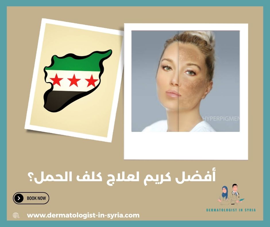 أفضل كريم لعلاج كلف الحمل؟ أفضل كريم لعلاج كلف الحمل؟