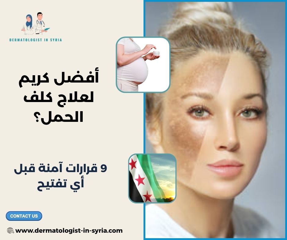 أفضل كريم لعلاج كلف الحمل؟