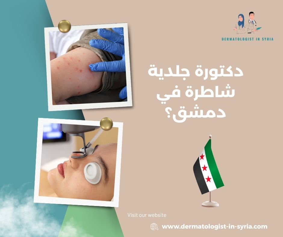 دكتورة جلدية شاطرة في دمشق؟