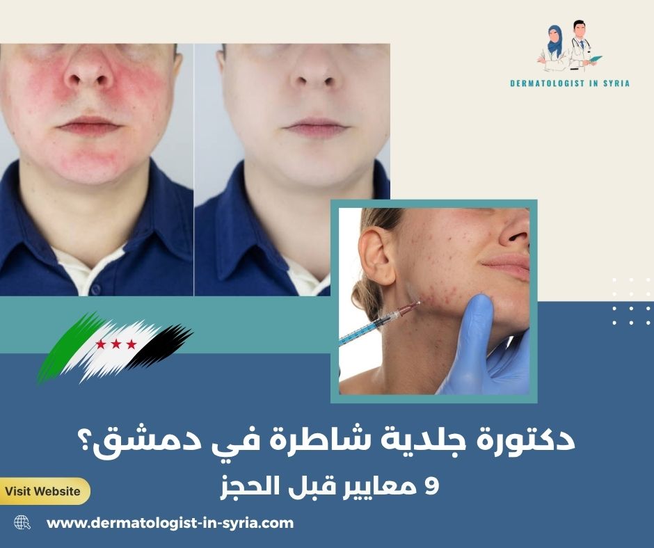 دكتورة جلدية شاطرة في دمشق؟