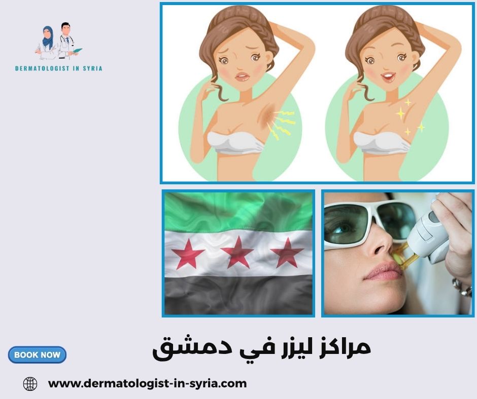 مراكز ليزر في دمشق مراكز ليزر في دمشق