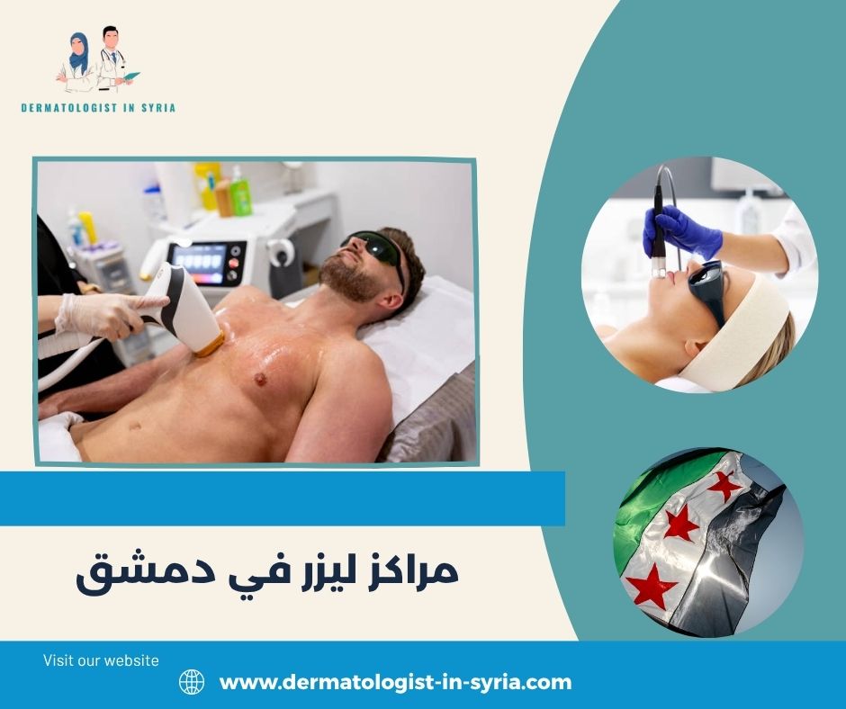 مراكز ليزر في دمشق مراكز ليزر في دمشق