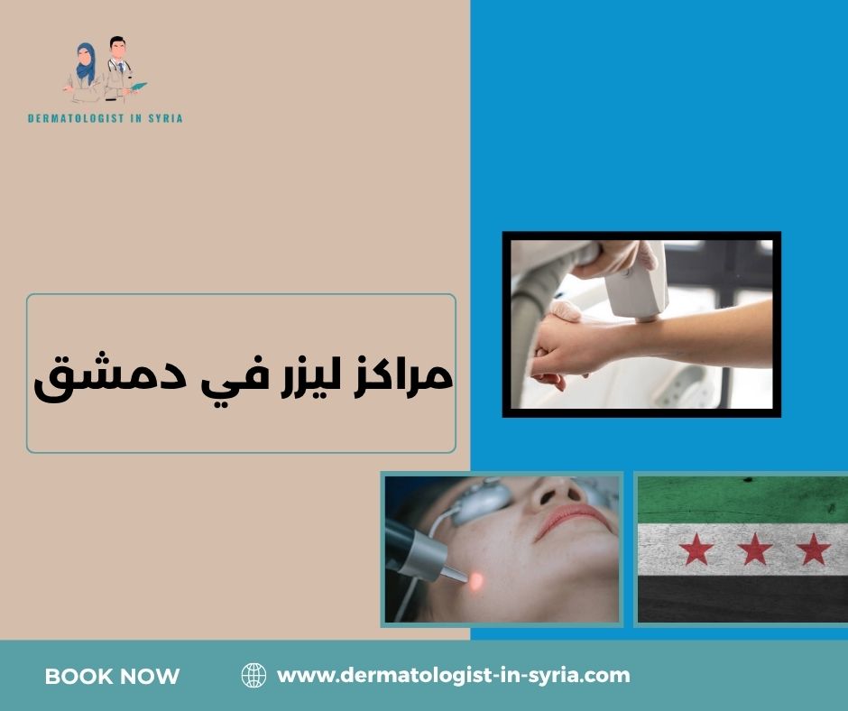 مراكز ليزر في دمشق مراكز ليزر في دمشق