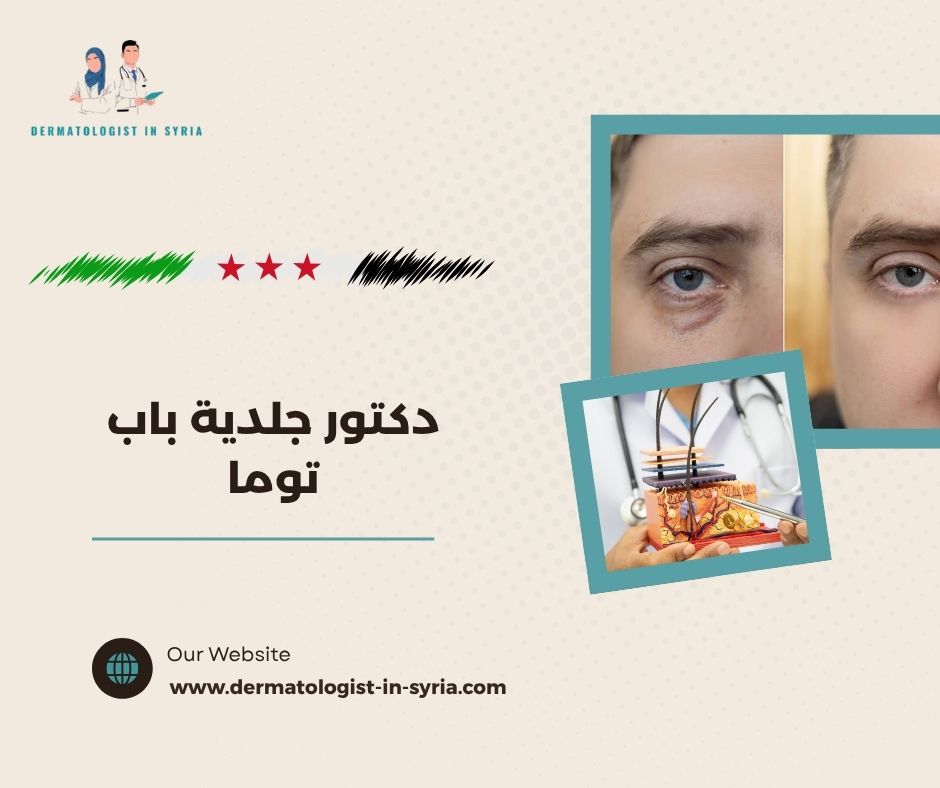 دكتور جلدية باب توما