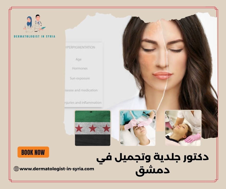 الدكتور حسام حديد دمشق