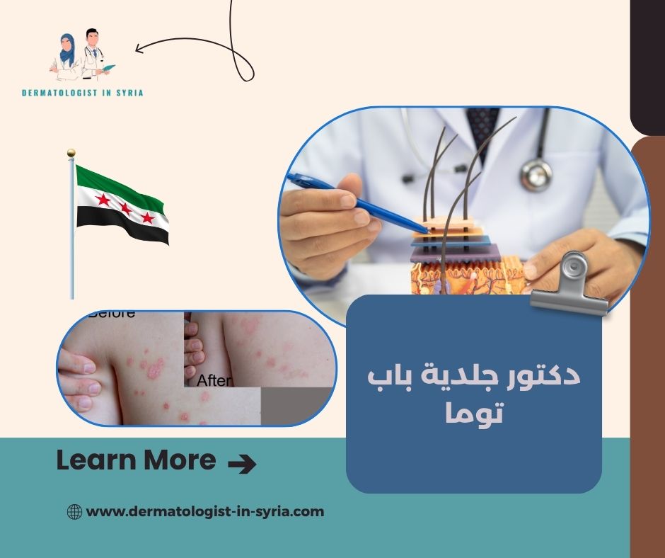 دكتور جلدية باب توما