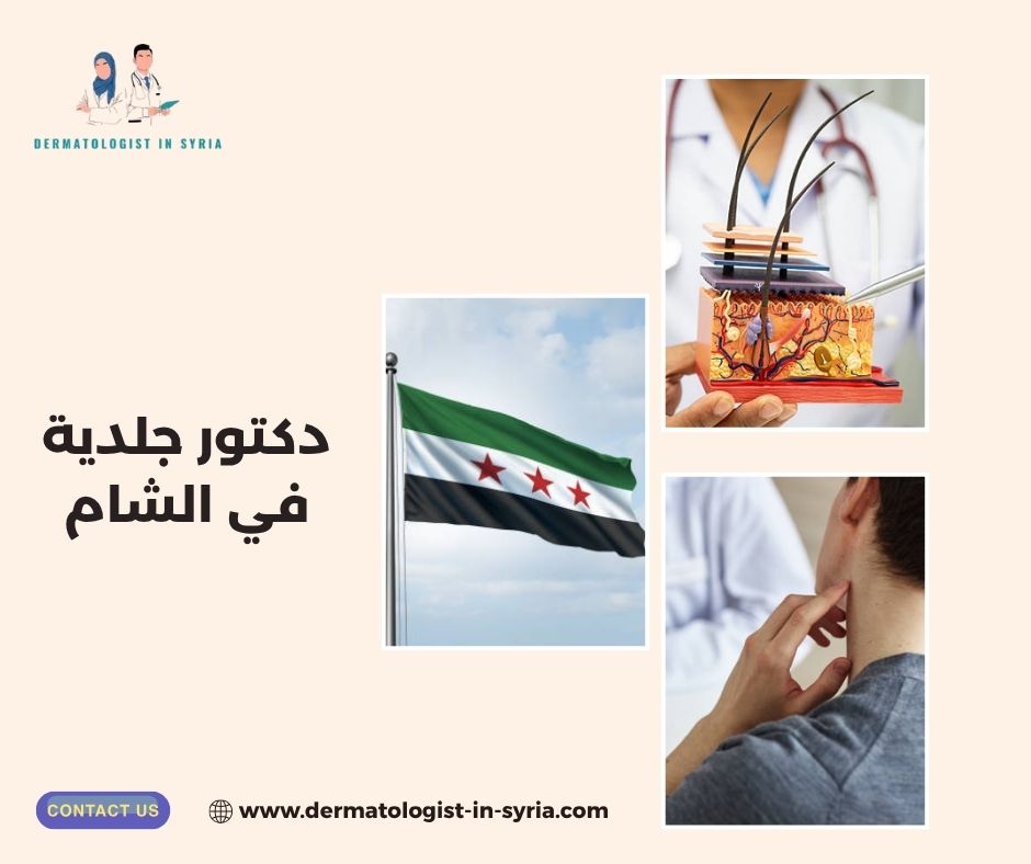 دكتور جلدية في الشام
