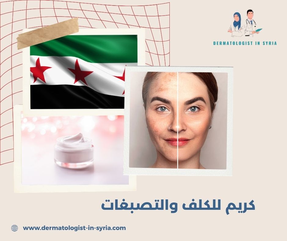 كريم للكلف والتصبغات كريم للكلف والتصبغات