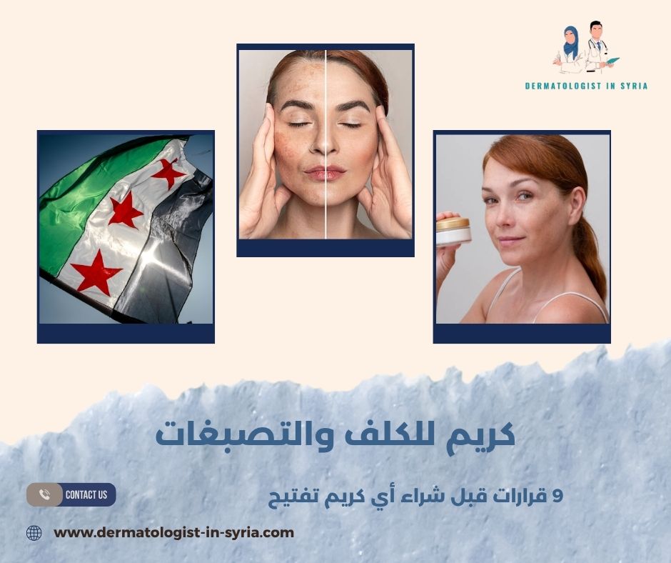 كريم للكلف والتصبغات