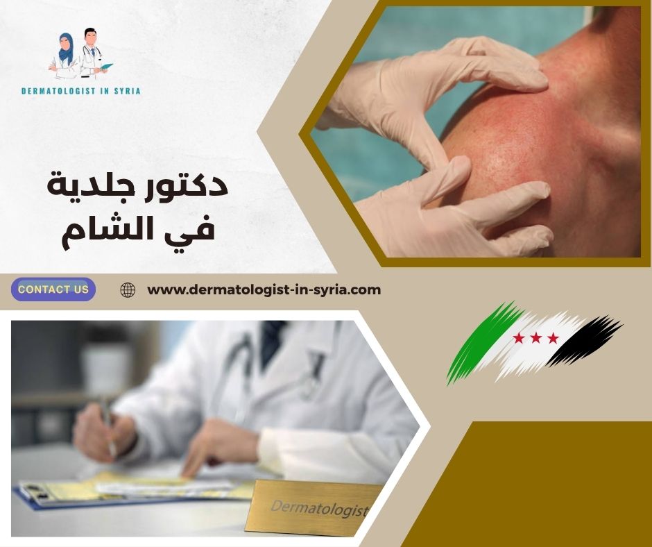 دكتور جلدية في الشام