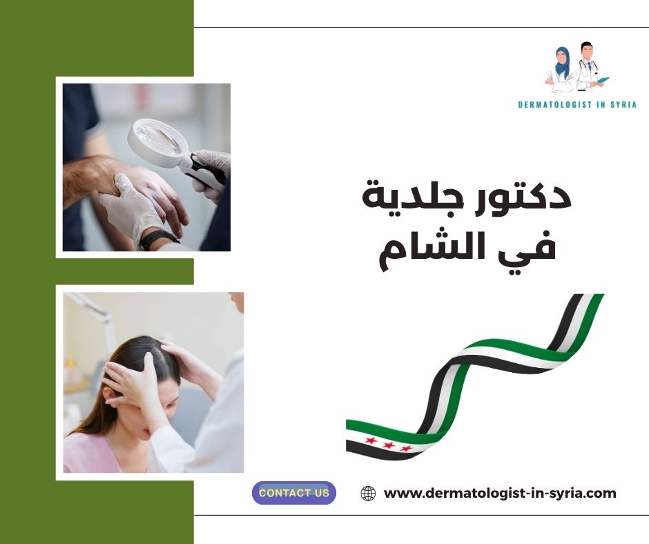 دكتور جلدية في الشام
